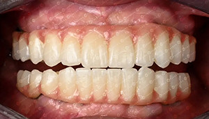 กรณี บริษัท ล่าสุดเกี่ยวกับ กรณีลูกค้า กล่องซิรคอนีย์ 4 มิติ