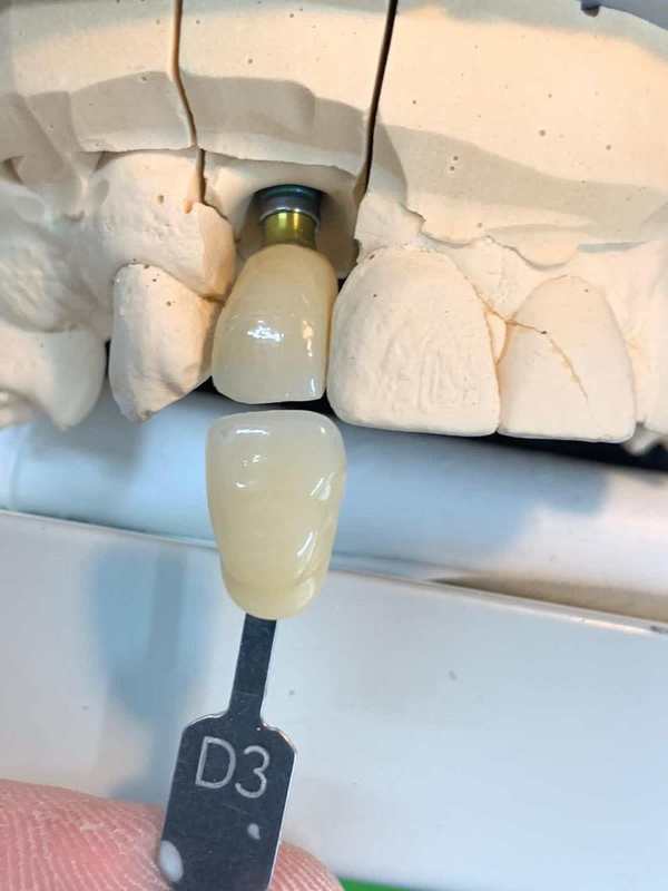 YUCERA Good Quality and Price Dental Materials and Laboratory Materials Dis and Dental Zirconia Block