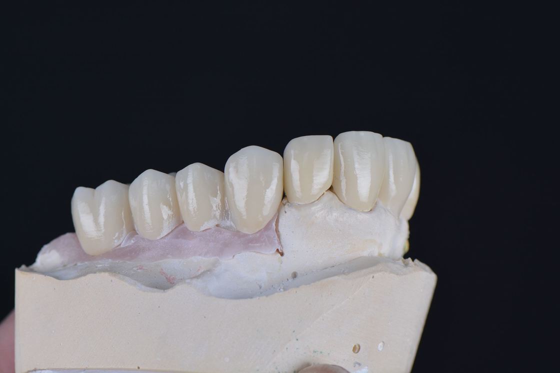 ความโปร่งแสง 43%-57% ความแข็งแรงในการดัดงอ 700-1200 MPa YUCERA Dental ระบบเปิด 98 มม. CAD/CAM 4D Pro Multilayer Zirconia Block