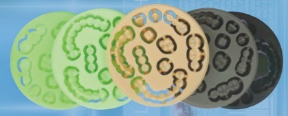 แผ่น PMMA คุณภาพสูงของ Yucera พร้อมบริการ OEM วัสดุทางทันตกรรมสำหรับห้องปฏิบัติการทันตกรรม