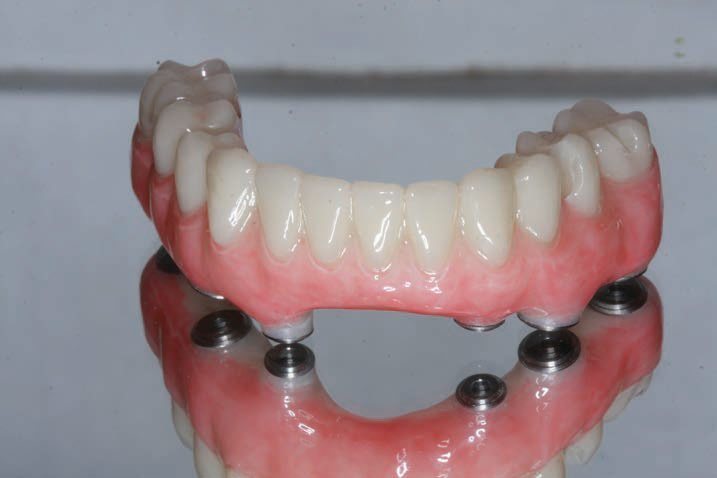 แผ่น PMMA หลายชั้นสำหรับ CAD CAM ของ Yucera, วัสดุทางทันตกรรม, แผ่น PMMA, บล็อกเซอร์โคเนียสำหรับทันตกรรม, แผ่นเรซิน PMMA แบบยืดหยุ่น