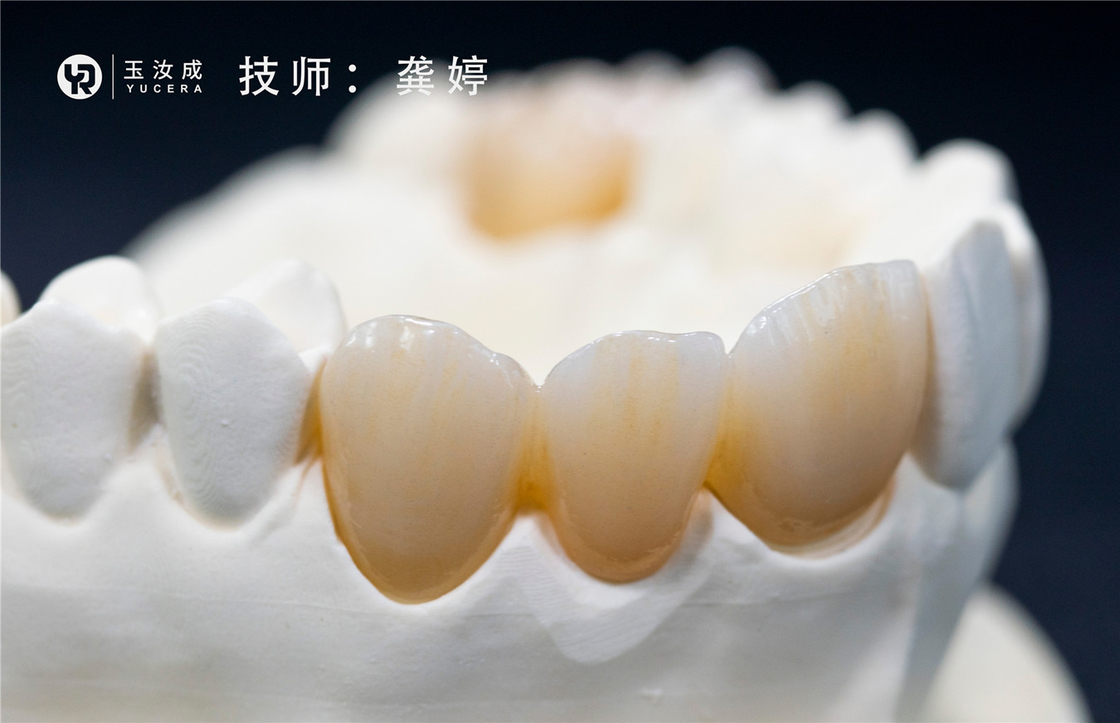 Yucera 3D Plus Multilaer Zirconia Block 98x16mm ระบบเปิดสำหรับมงกุฎหลัง